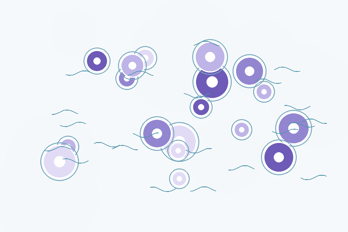 Illustration for glioblastoma